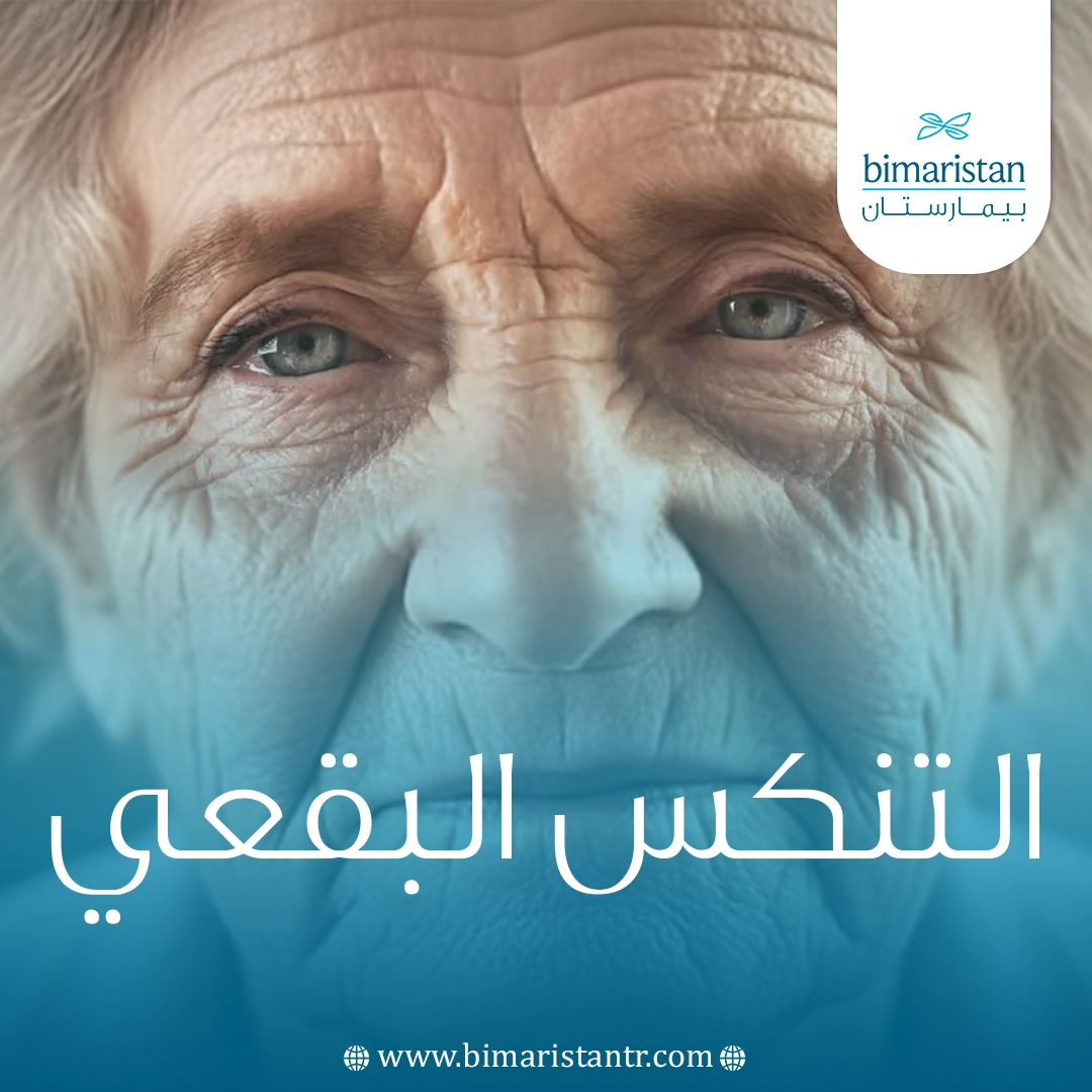 التنكس البقعي