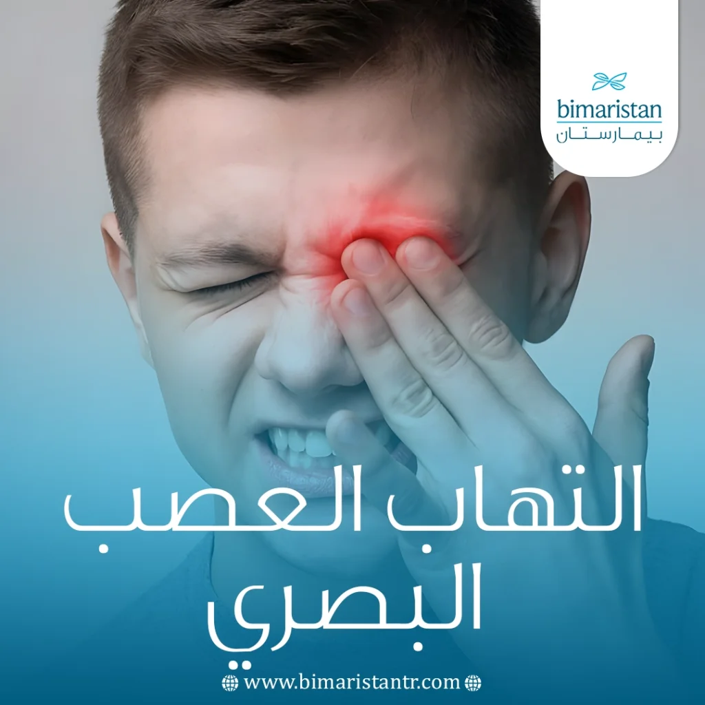 التهاب العصب البصري: الأسباب والأعراض وخيارات العلاج الحديثة 5 التهاب العصب البصري