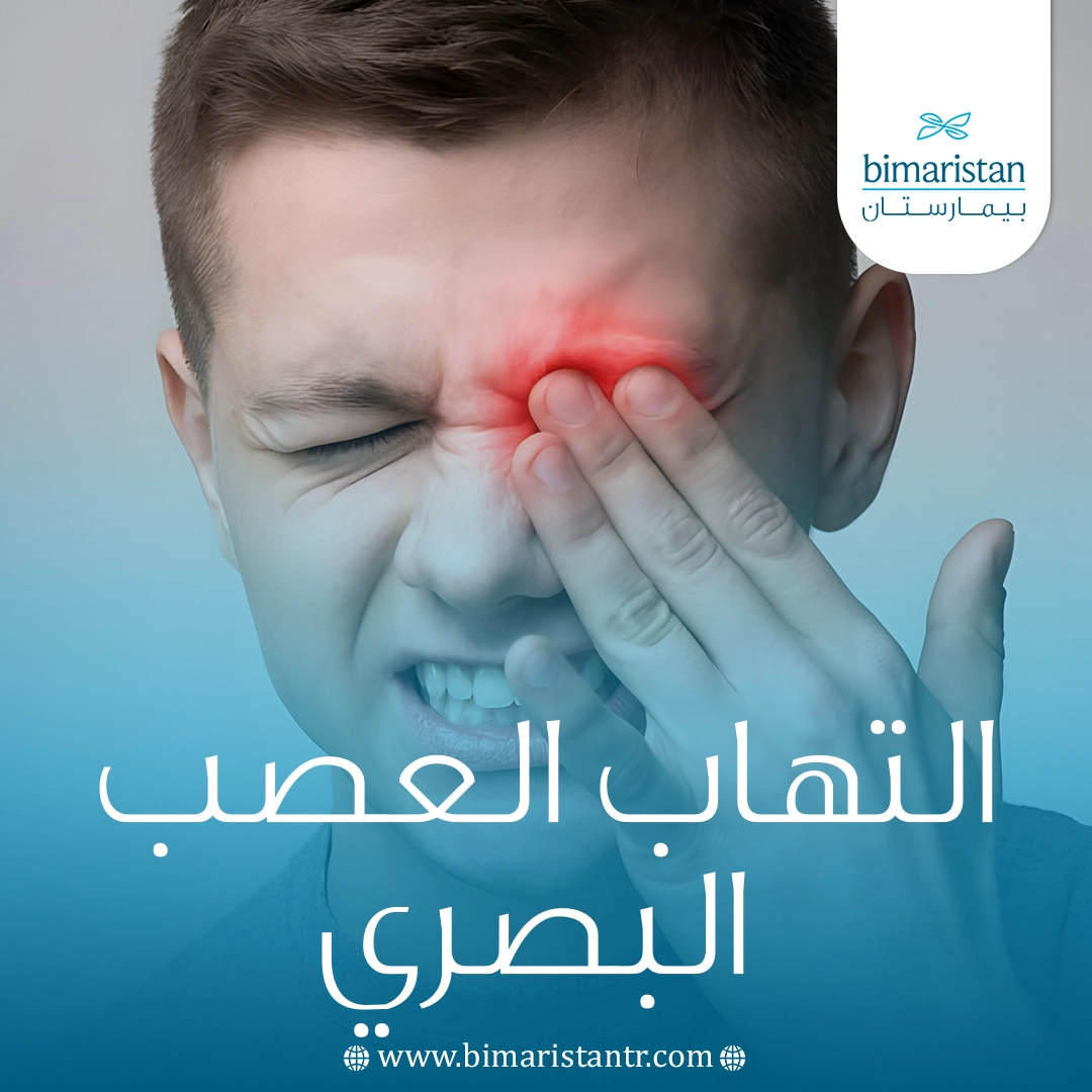 التهاب العصب البصري