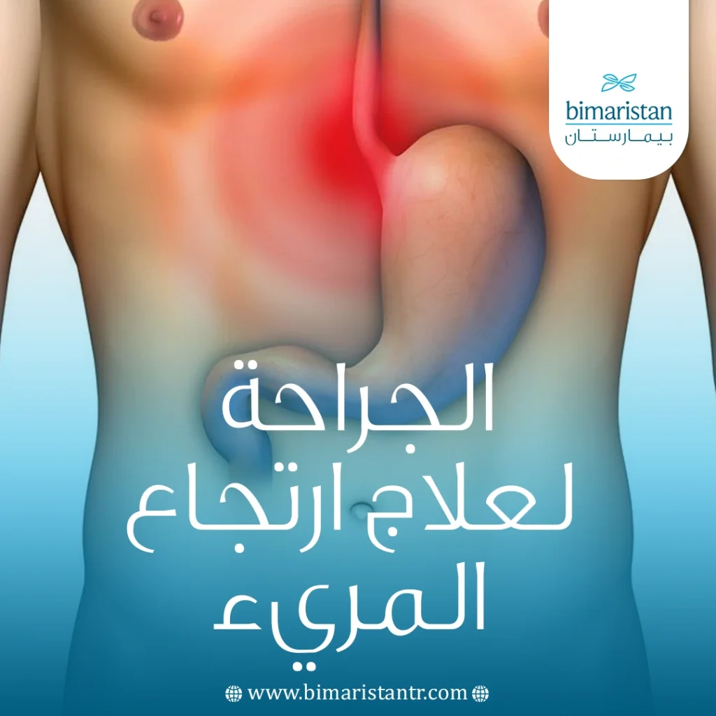 الجراحة لعلاج ارتجاع المريء
