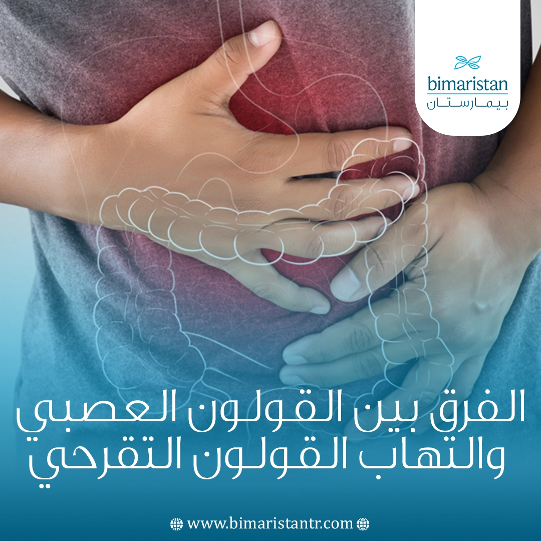 الفرق بين القولون العصبي والتهاب القولون التقرحي