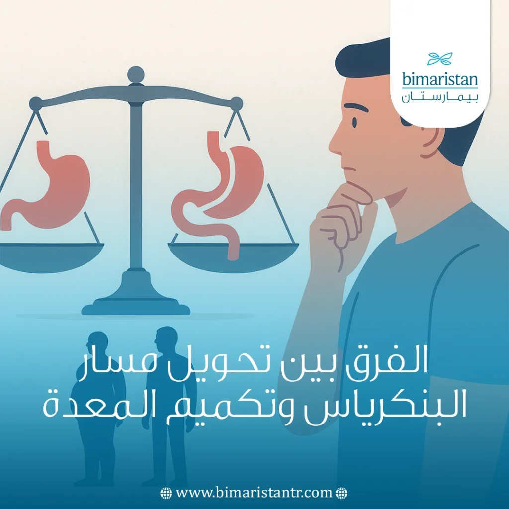 الفرق بين تحويل مسار البنكرياس وتكميم المعدة 6 الفرق بين تحويل مسار البنكرياس وتكميم المعدة