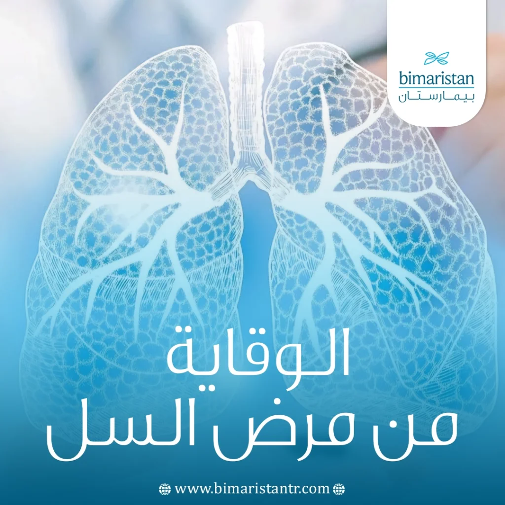 الوقاية من مرض السل: أهم الطرق لحماية نفسك ومن حولك 6 الوقاية من مرض السل