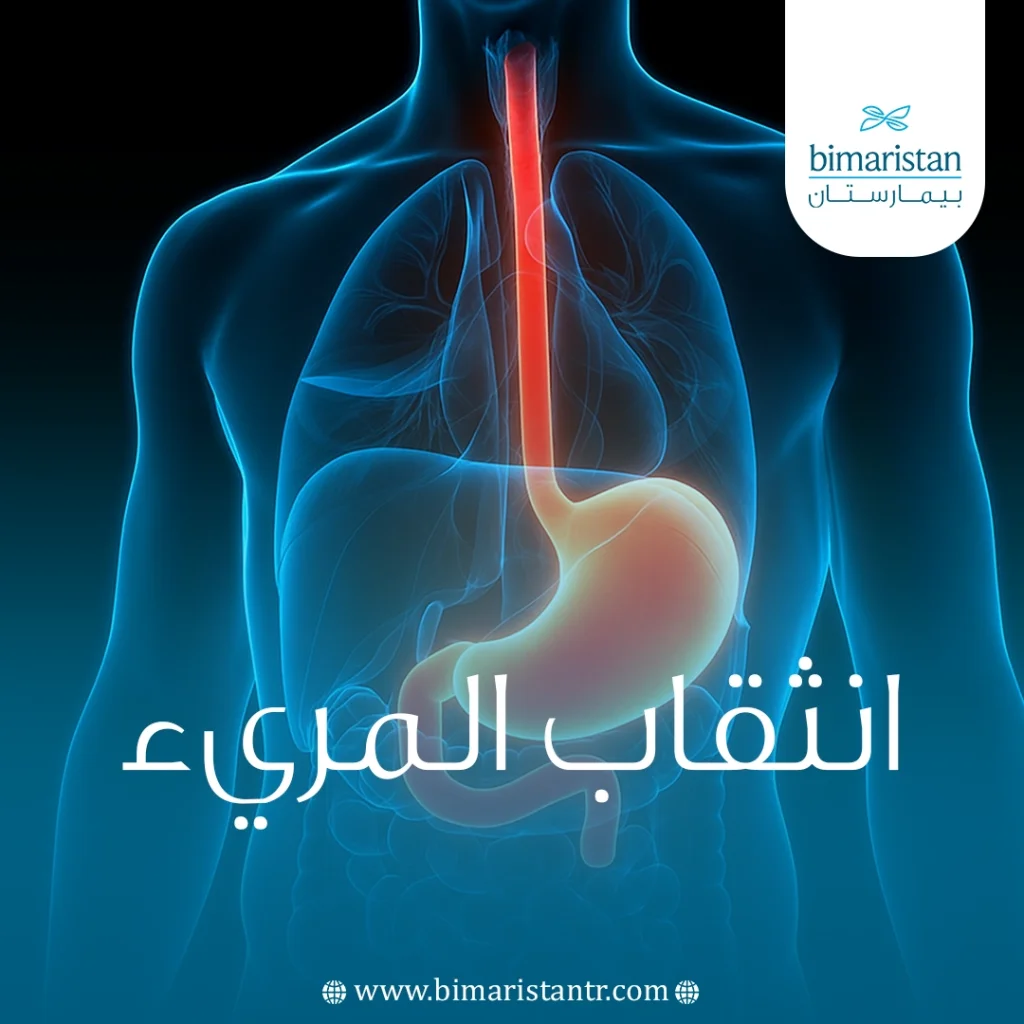 انثقاب المريء: أسبابه وأعراضه وتشخيصه وطرق العلاج المتقدمة في تركيا 6 انثقاب المريء