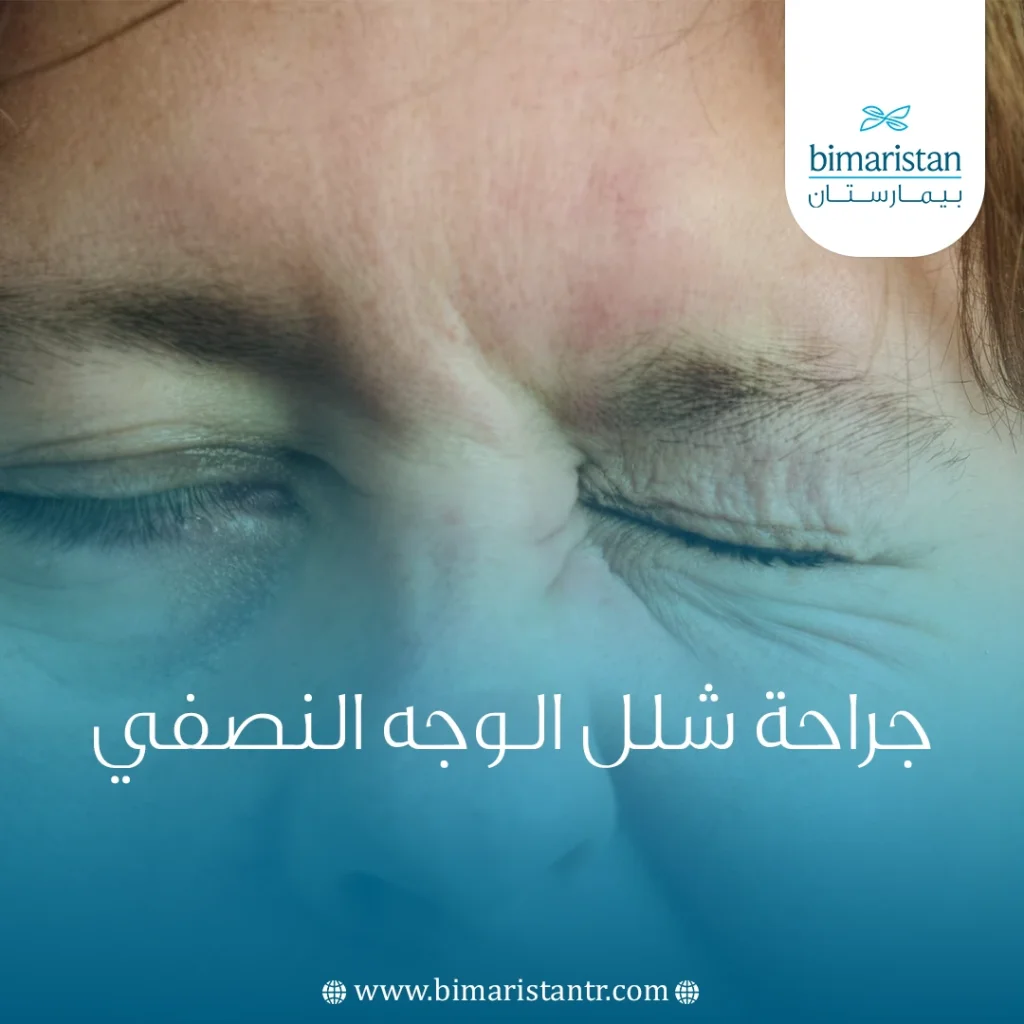 جراحة شلل الوجه النصفي: حلول متقدمة لتستعيد ابتسامتك 3 جراحة شلل الوجه النصفي