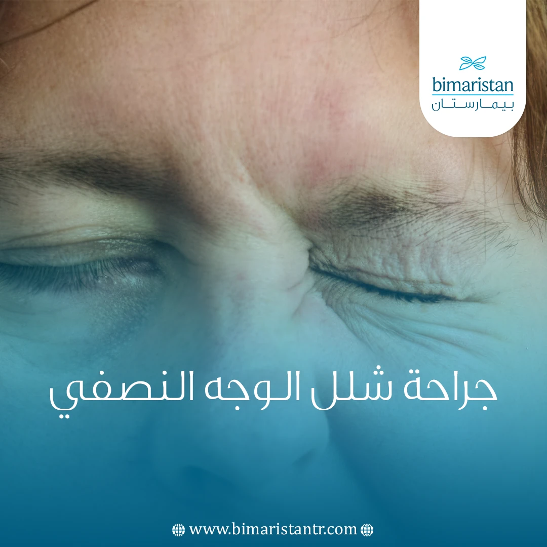 جراحة شلل الوجه النصفي