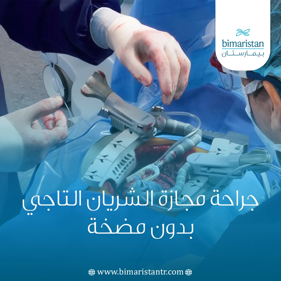 جراحة مجازة الشريان التاجي بدون مضخة