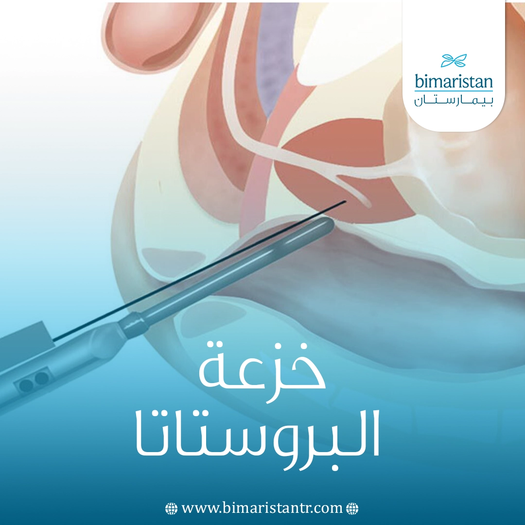 خزعة البروستاتا