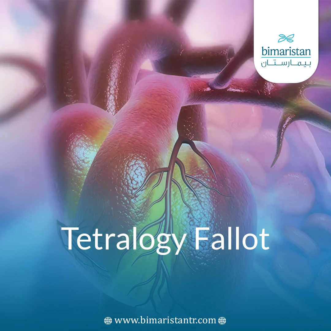 Tetralogy Of Fallot In Children: Symptoms, Diagnosis, And Surgery Options 82 Tetralogy Of Fallot