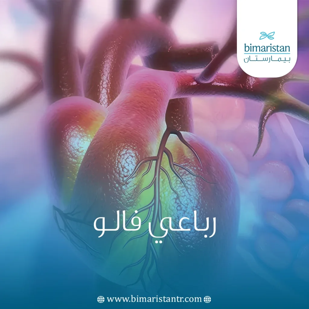 رباعي فالو