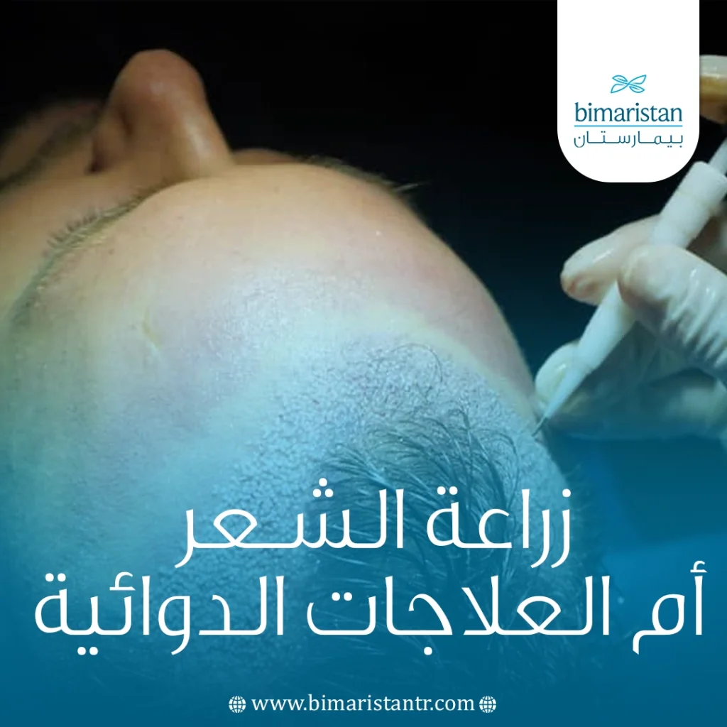 زراعة الشعر أم العلاجات الدوائية: أيهما أنسب للتخلص من تساقط الشعر؟ 4 زراعة الشعر أم العلاجات الدوائية