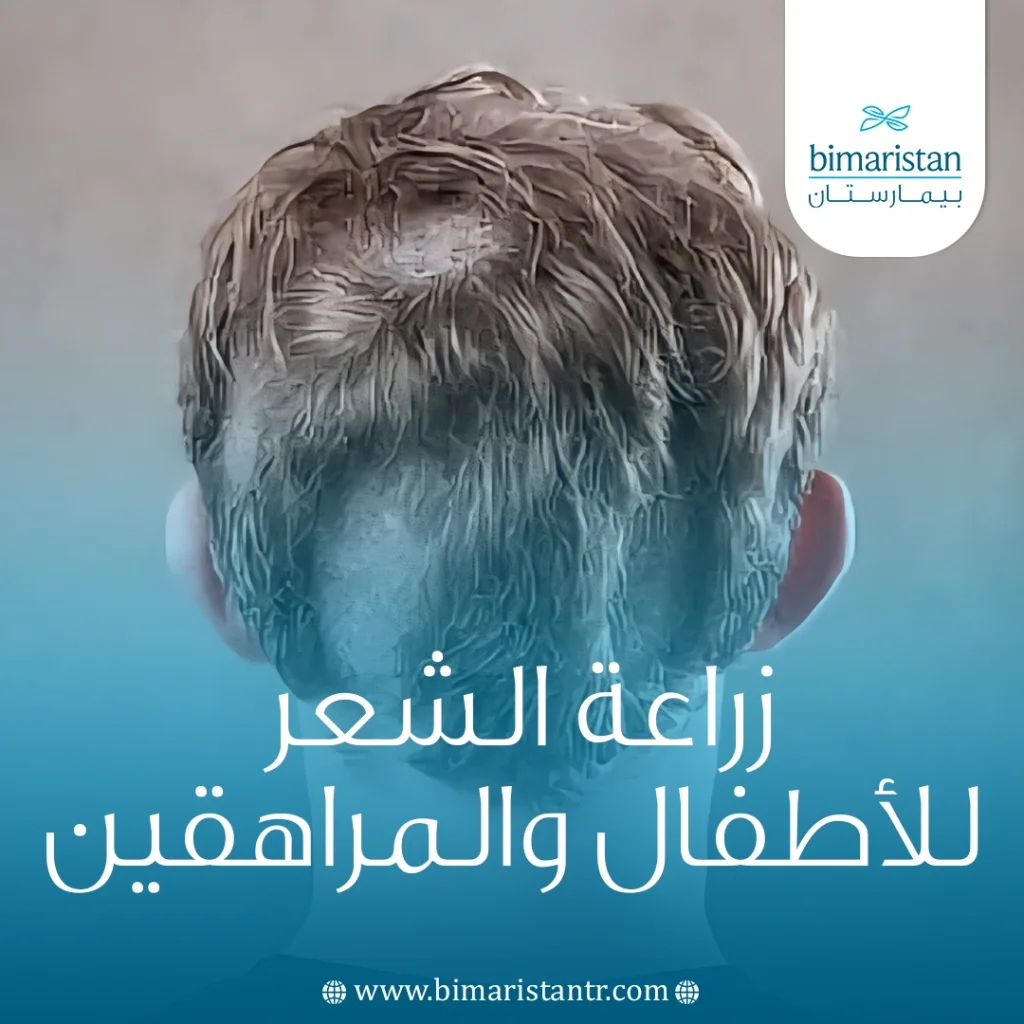 زراعة الشعر للأطفال و المراهقين