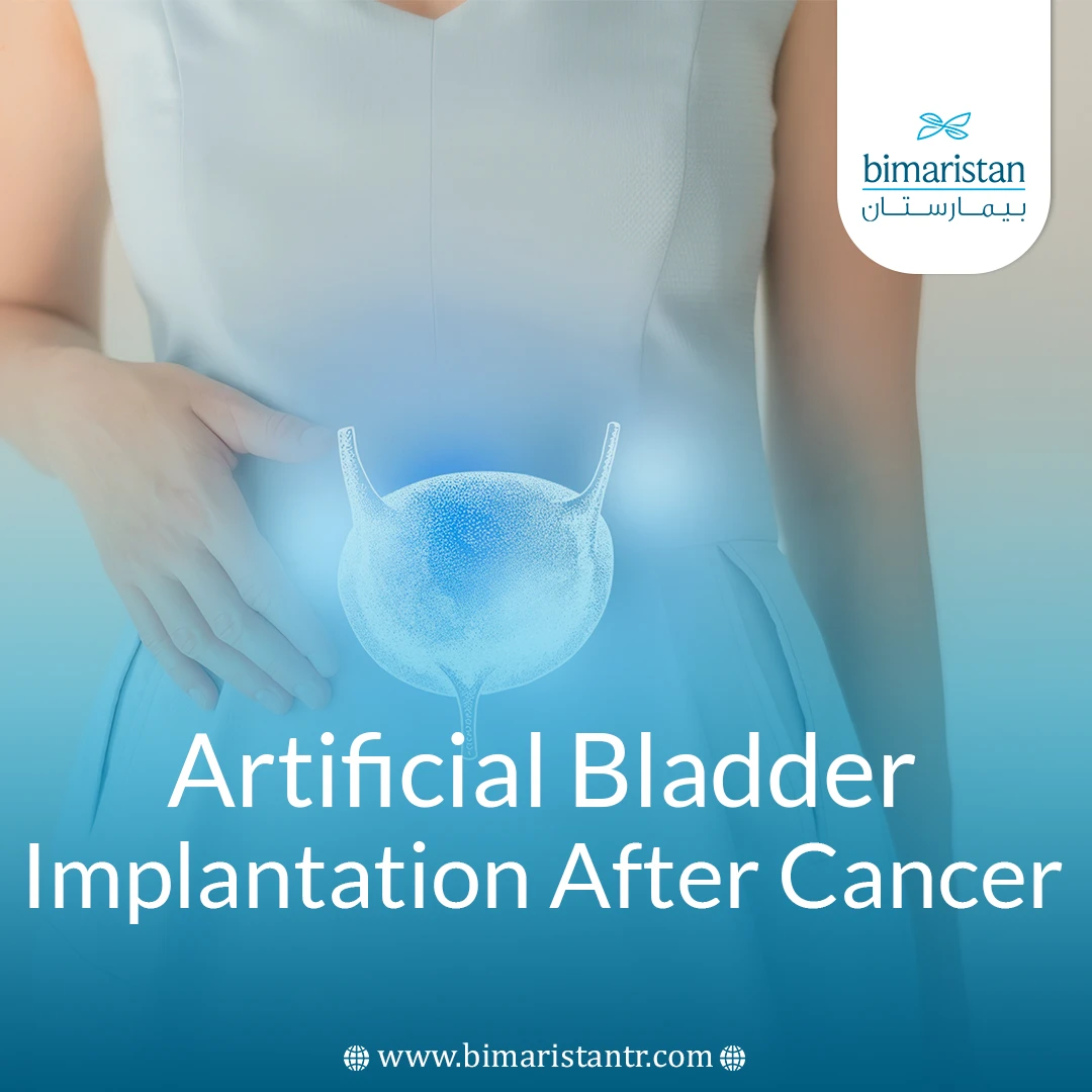 Artificial Bladder Implantation After Cancer