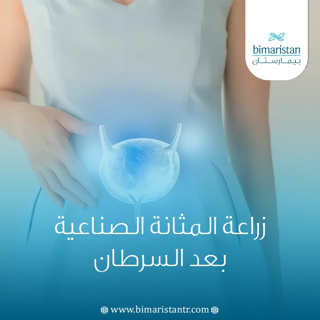 زراعة المثانة الصناعية بعد السرطان