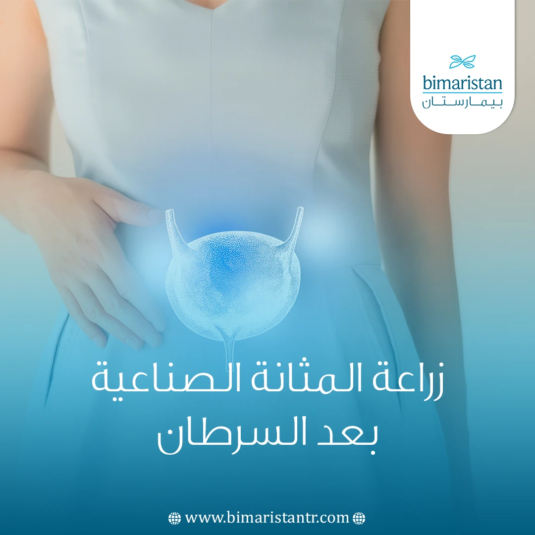 زراعة المثانة الصناعية بعد السرطان