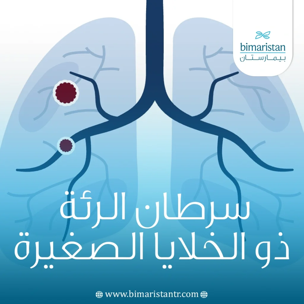 سرطان الرئة ذو الخلايا الصغيرة