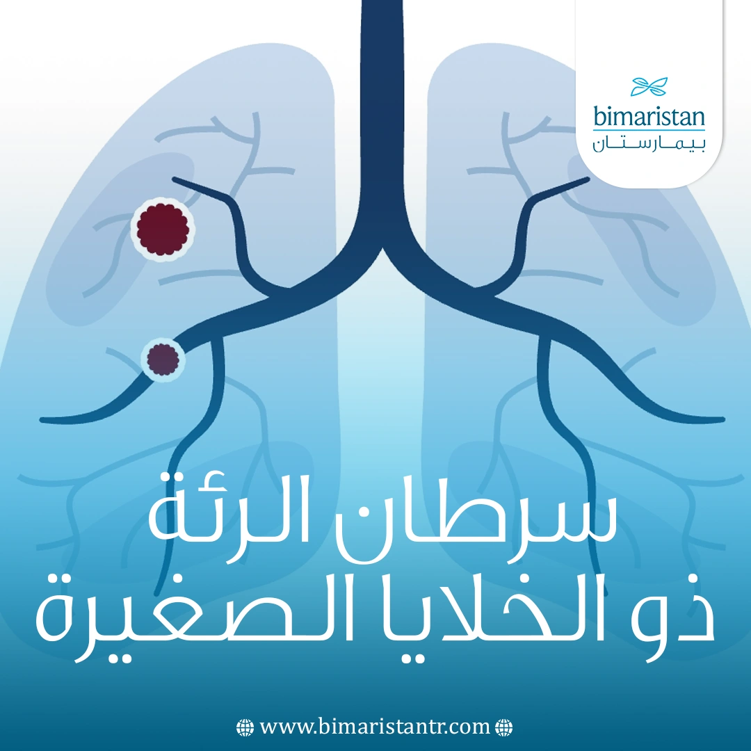 سرطان الرئة ذو الخلايا الصغيرة