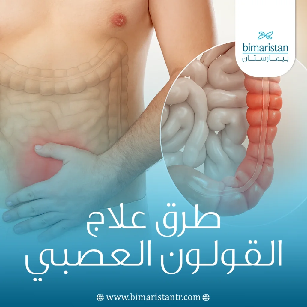 طرق علاج القولون العصبي: أعراضه وأحدث العلاجات 6 طرق علاج القولون العصبي