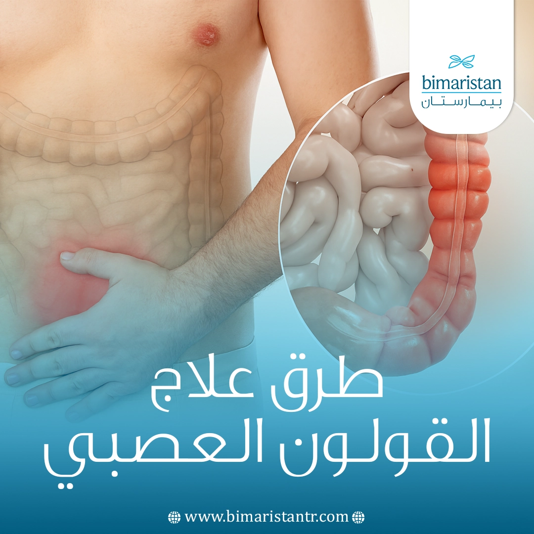 طرق علاج القولون العصبي