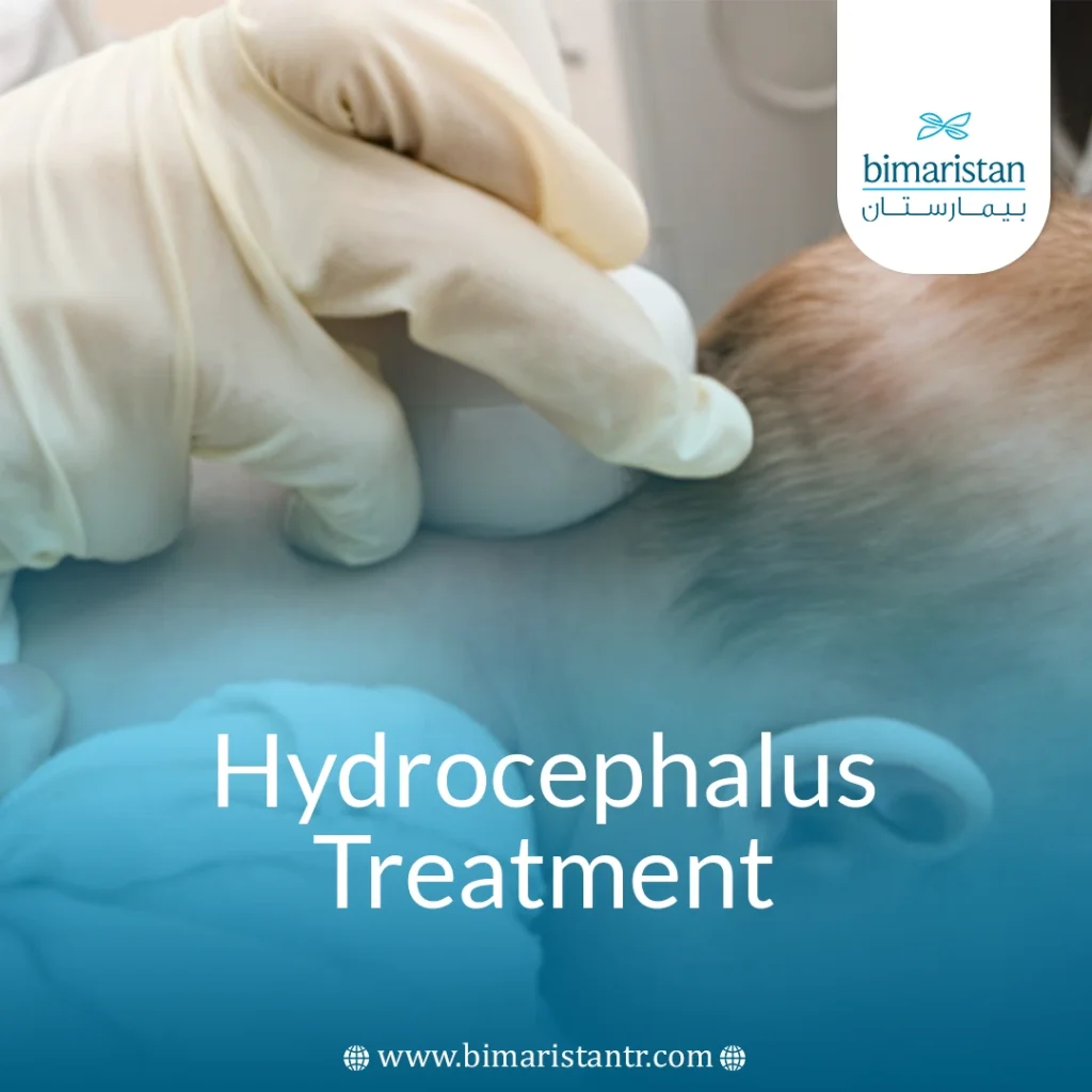 Hydrocephalus Treatment