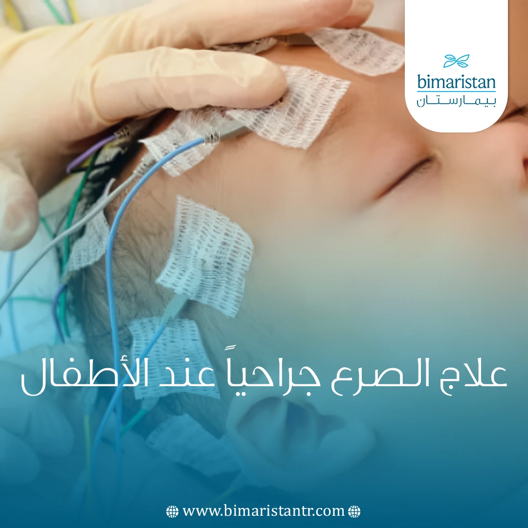علاج الصرع جراحياً عند الأطفال