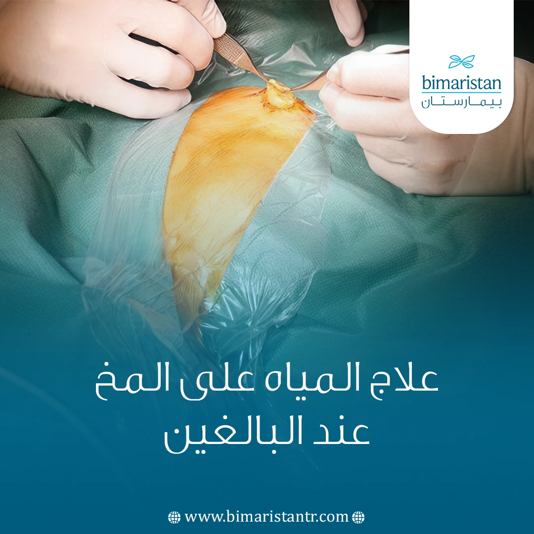 علاج المياه على المخ عند البالغين