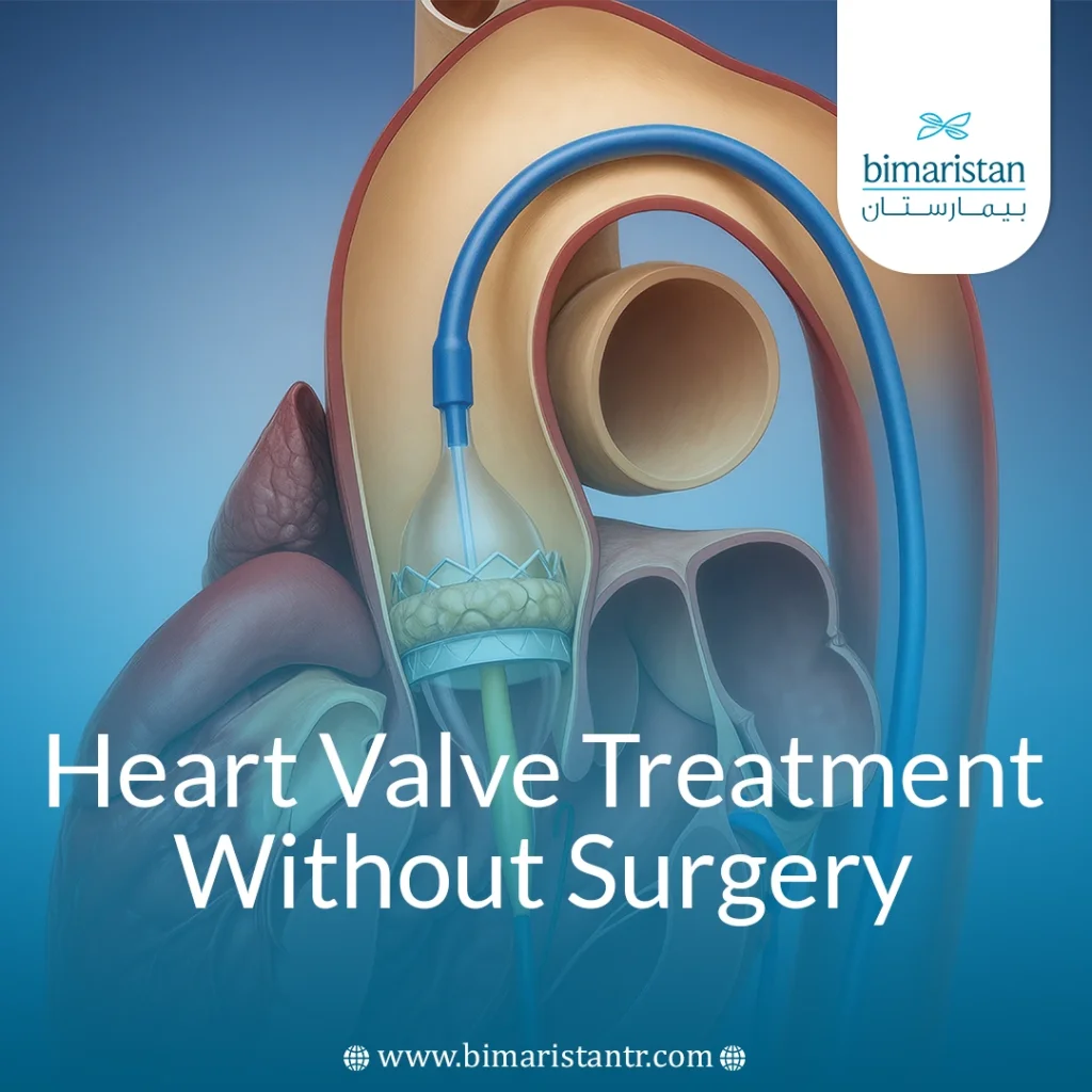 Heart Valve Treatment Without Surgery
