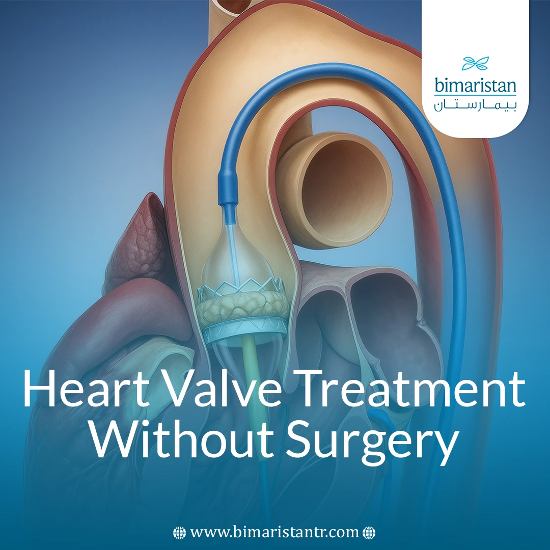 Heart Valve Treatment Without Surgery