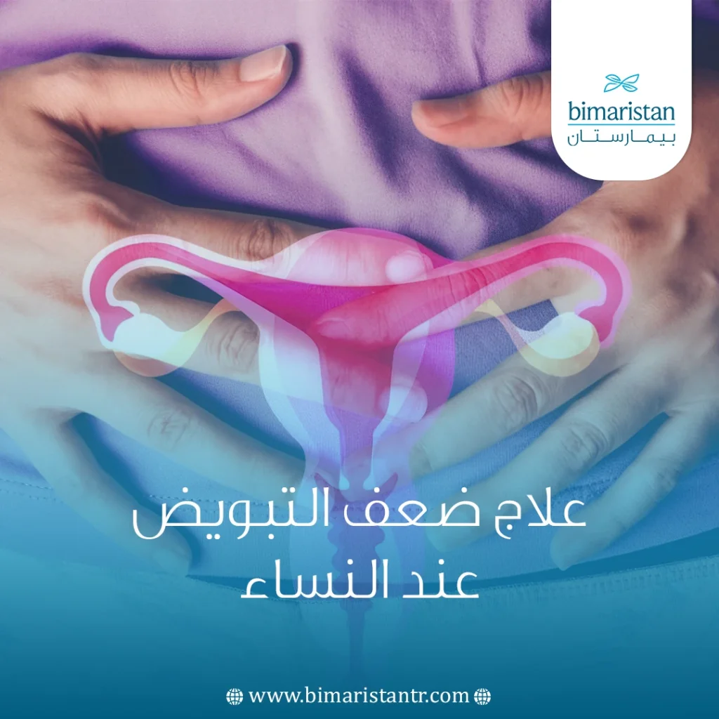 علاج ضعف التبويض عند النساء