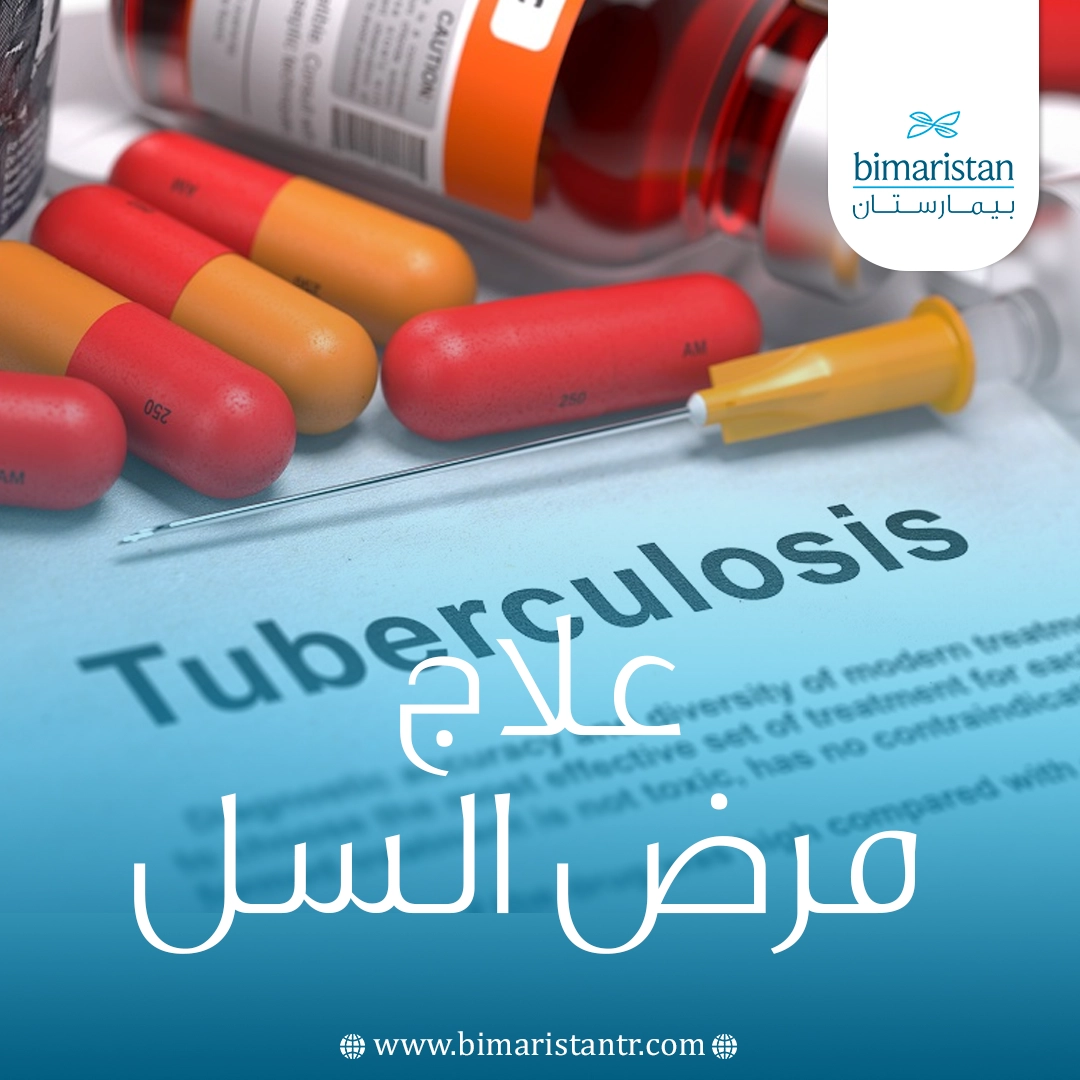 علاج مرض السل