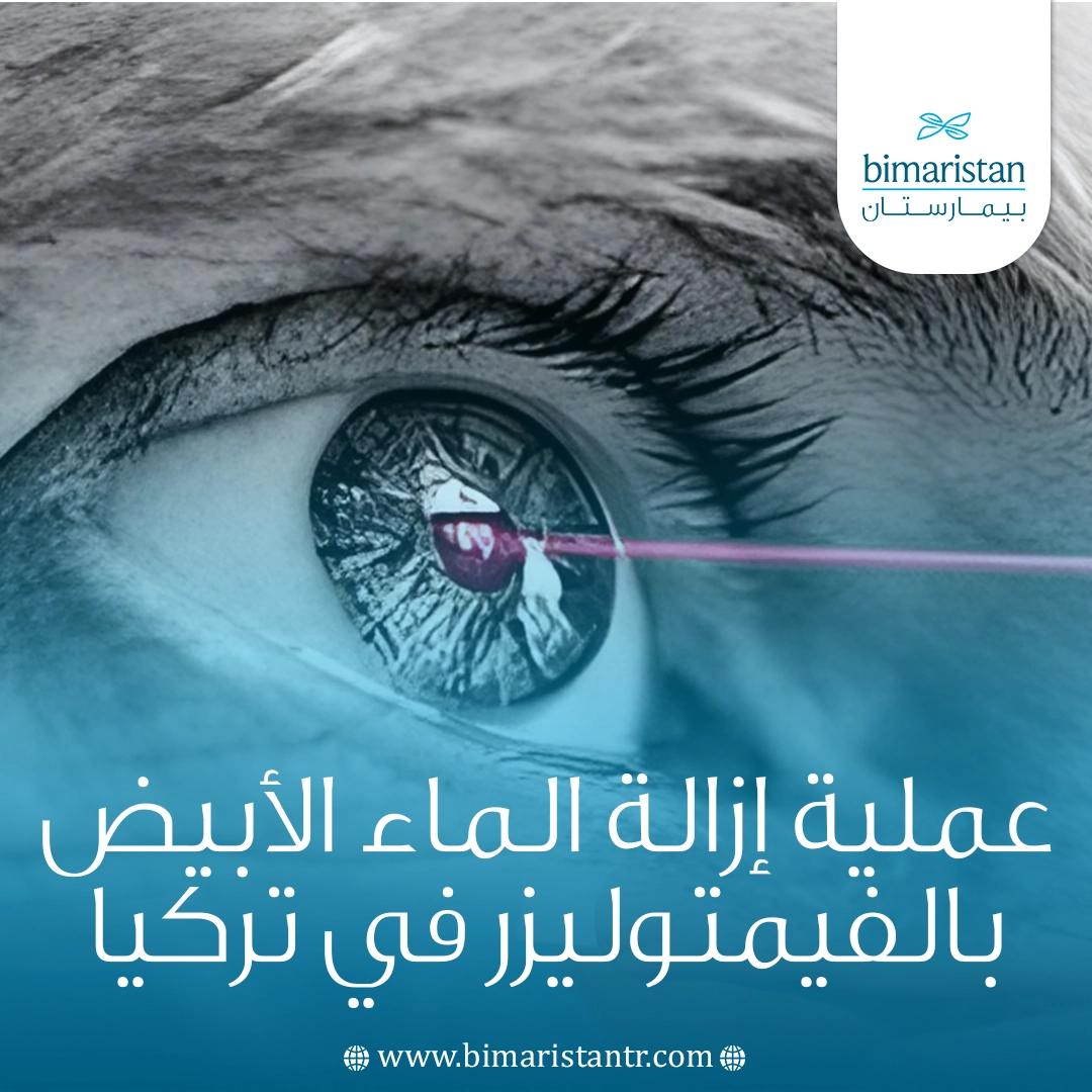 عملية إزالة الماء الأبيض بالفيمتوليزر في تركيا