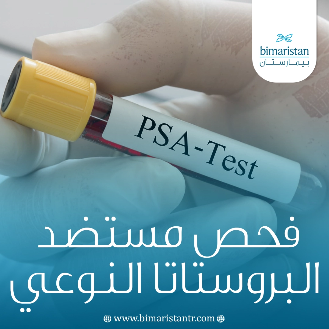 فحص مستضد البروستاتا النوعي