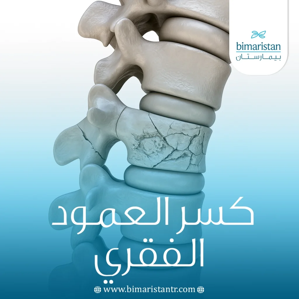 كسر العمود الفقري: الأعراض وطرق العلاج 15 كسر العمود الفقري