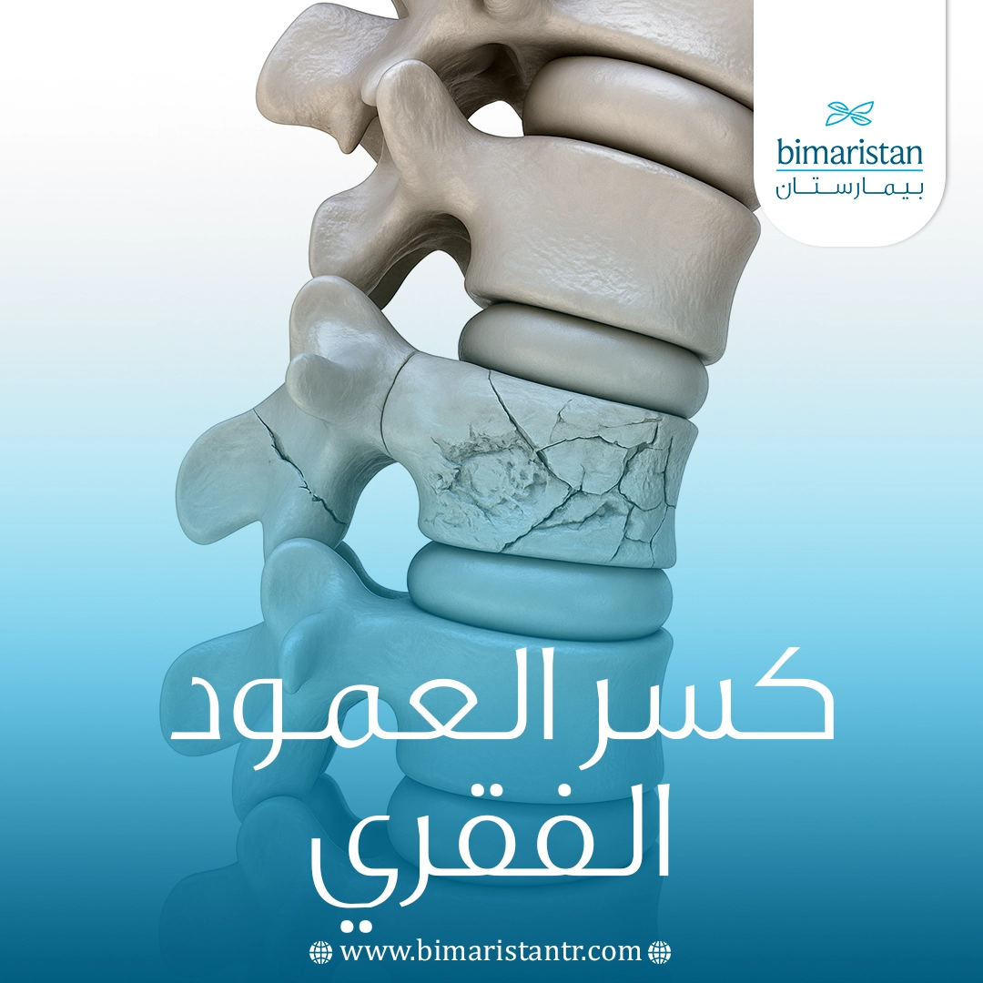 كسر العمود الفقري