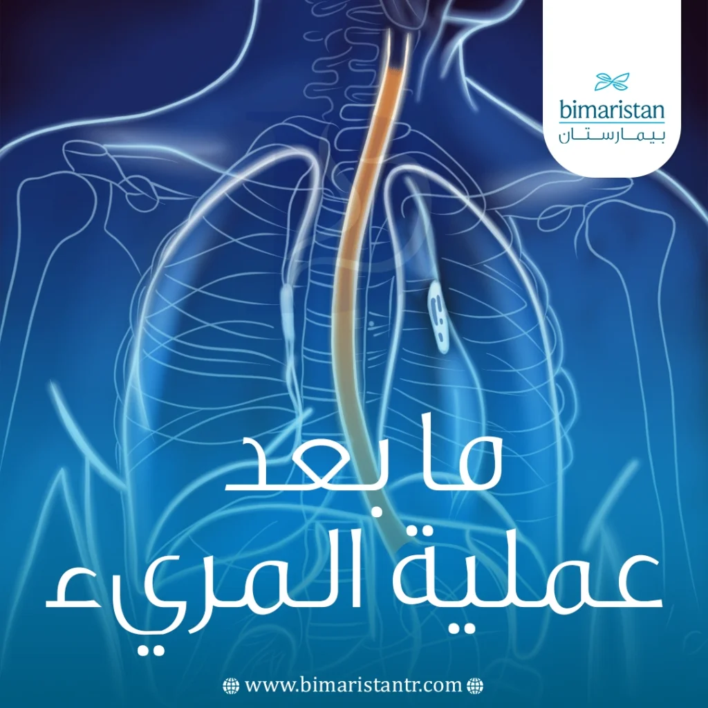 ما بعد عملية المريء