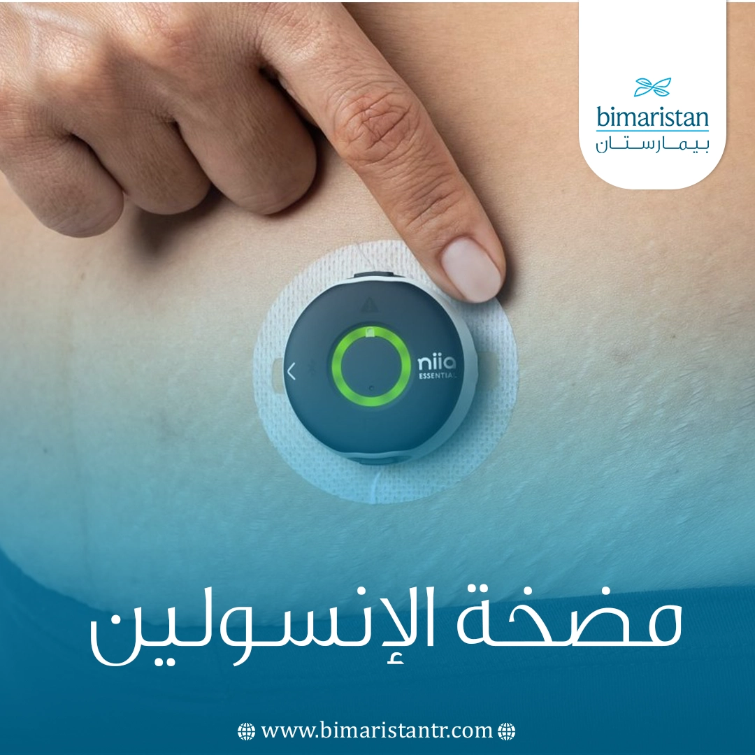 مضخة الإنسولين