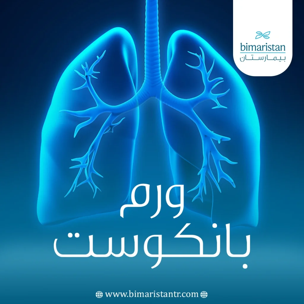 ورم بانكوست