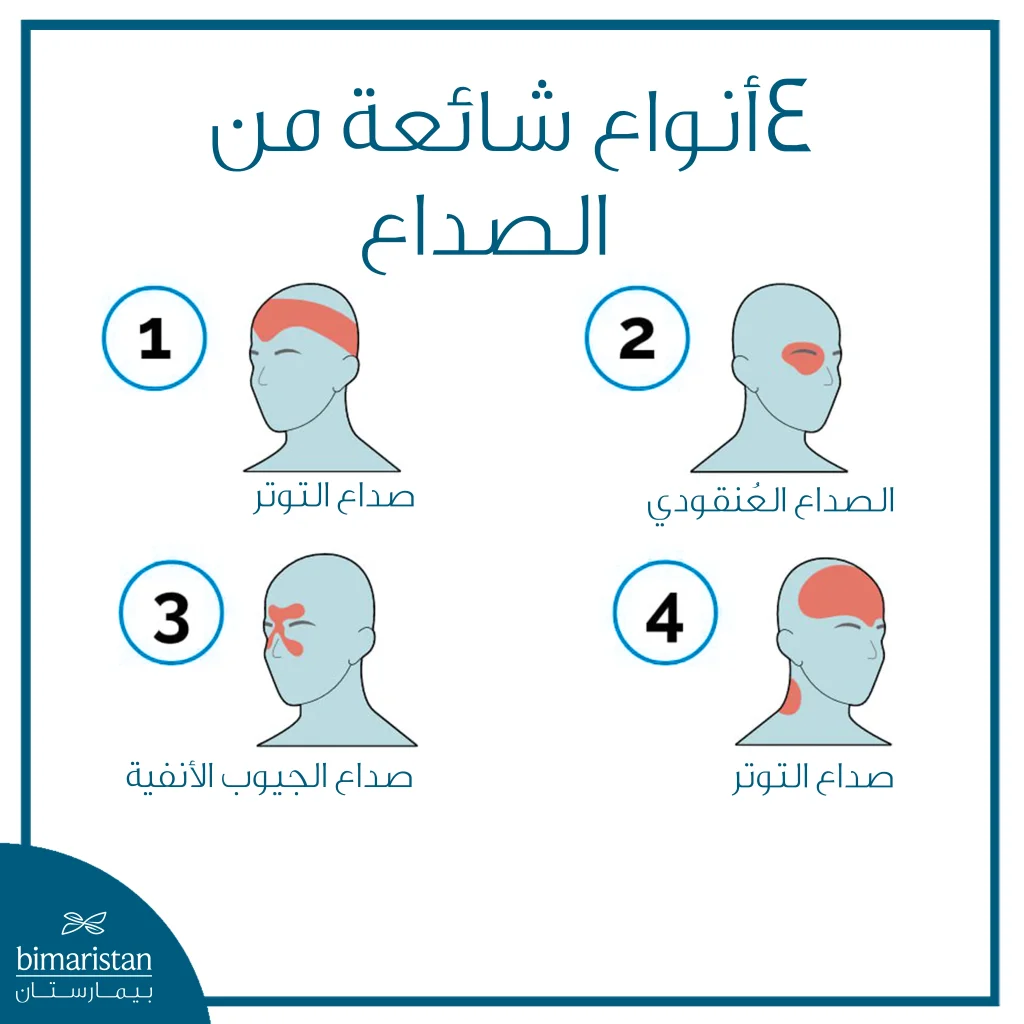 أنواع شائعة من الصداع