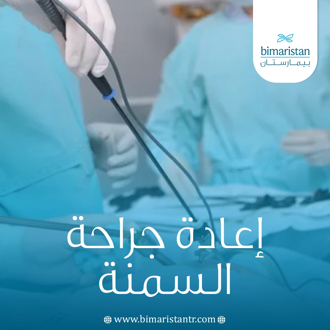 إعادة جراحة السمنة