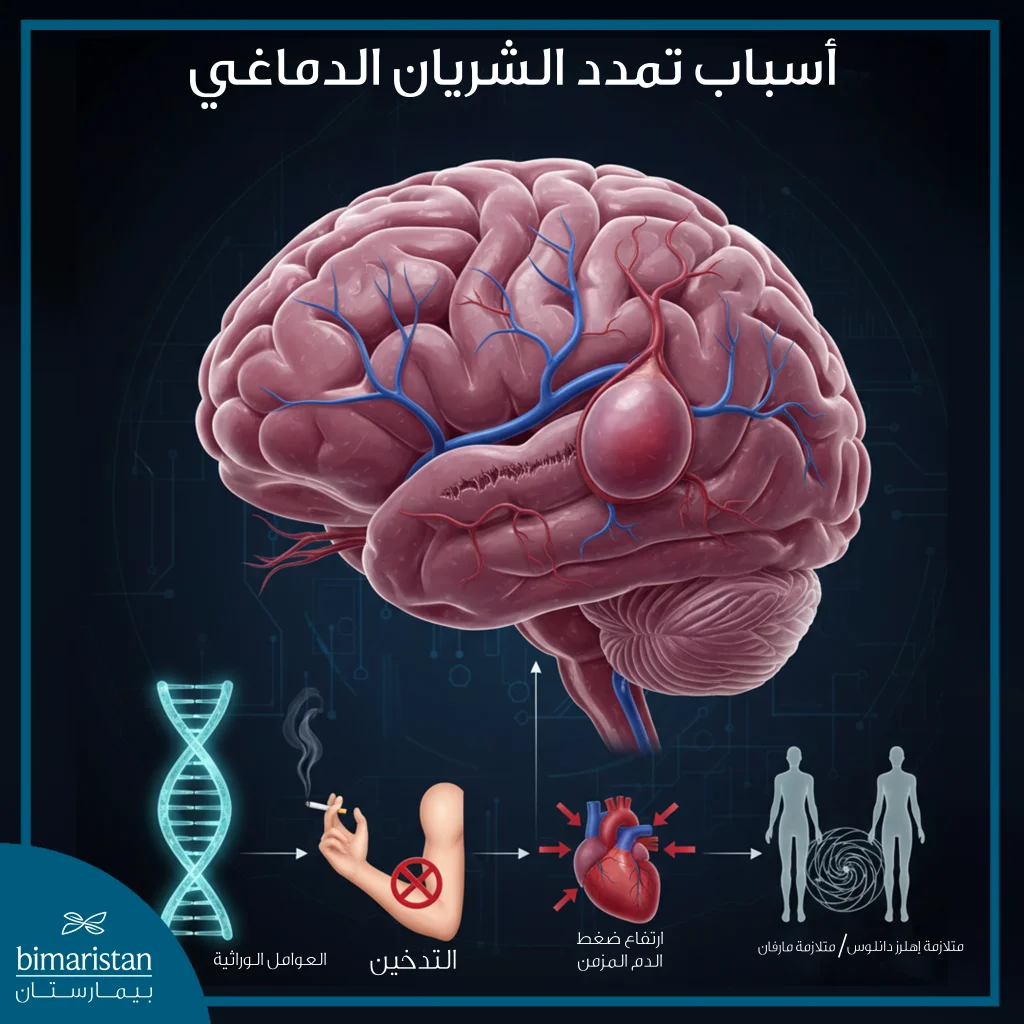 توضح الصورة أسباب تمدد الشريان الدماغي