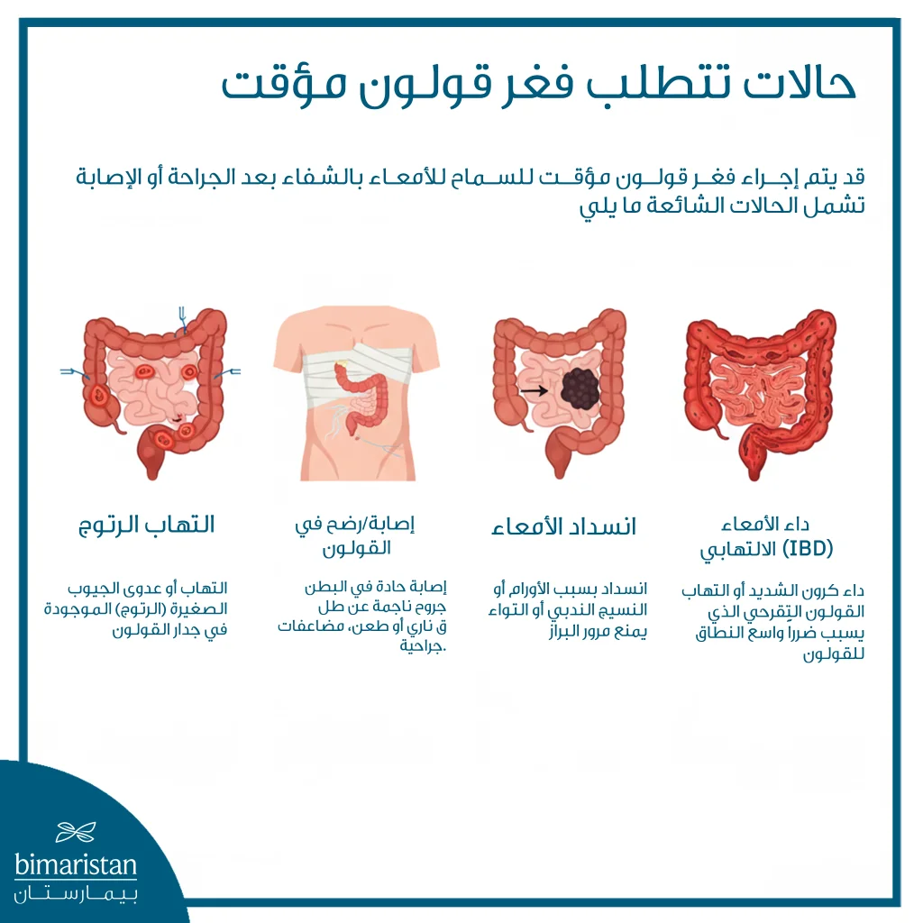 فغر القولون: دليل شامل للعملية والرعاية بعدها 5 توضح الصورة الحالات التي تتطلب فغر قولون مؤقت