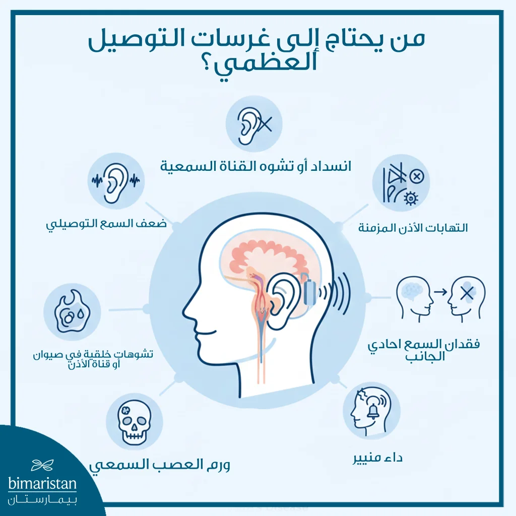 توضح الصورة الحالات التي تحتاج غرسات التوصيل العظمي