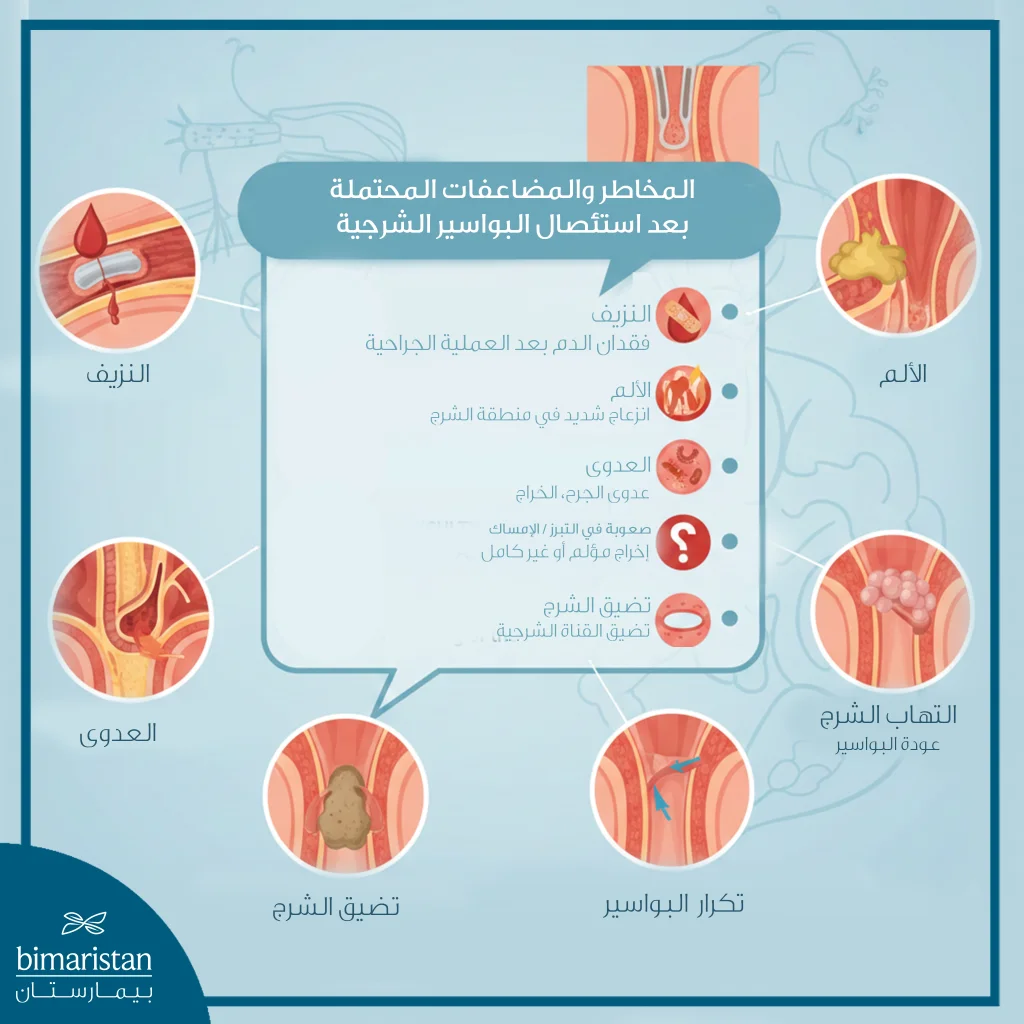استئصال البواسير الجراحي: المخاطر وفترة الشفاء 6 توضح الصورة المخاطر والمضاعفات المحتملة بعد استئصال البواسير الشرجية