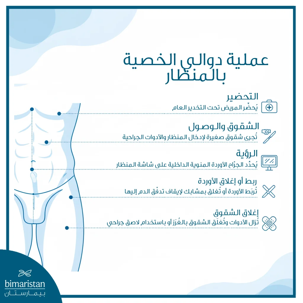 توضح الصورة خطوات عملية دوالي الخصية بالمنظار