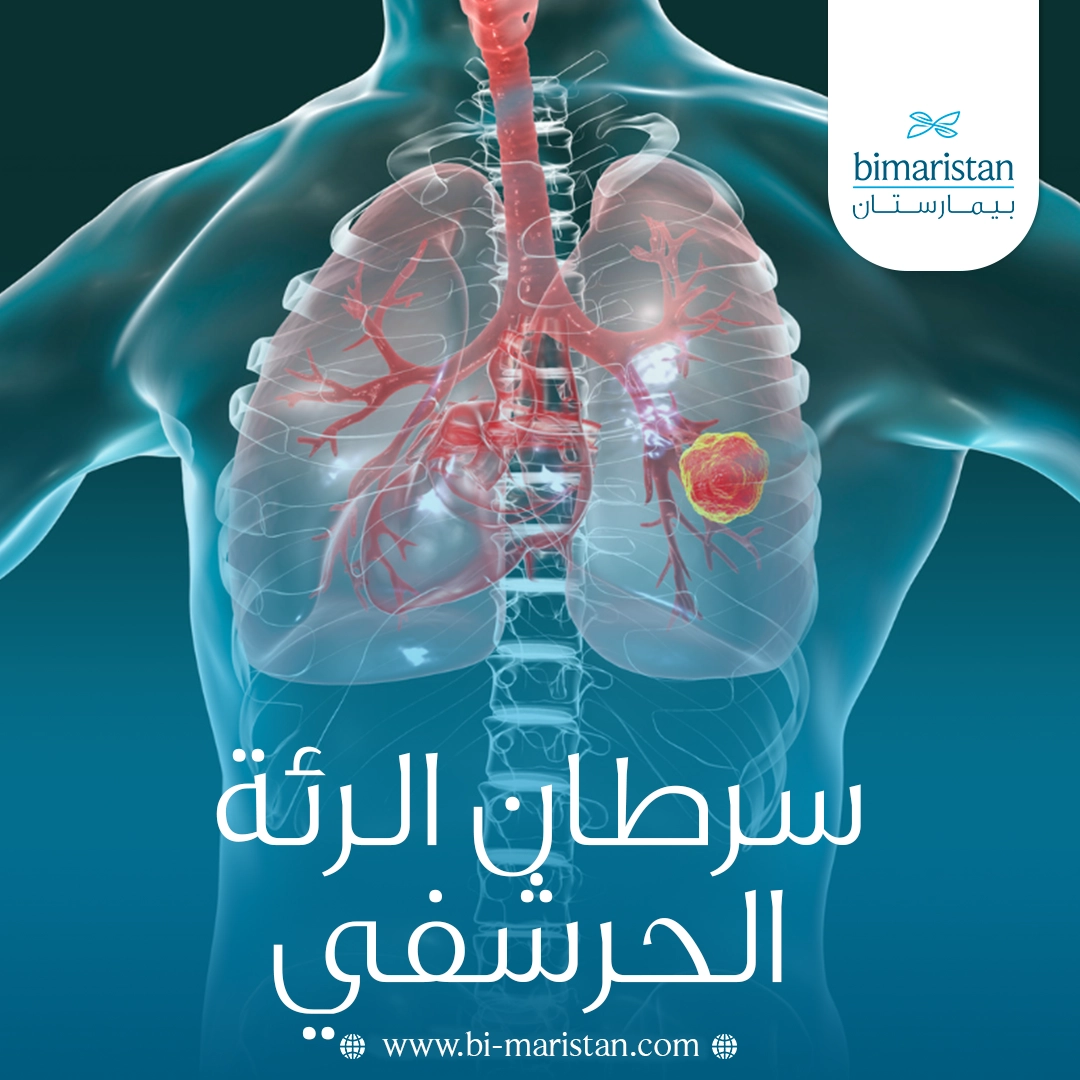 سرطان الرئة الحرشفي