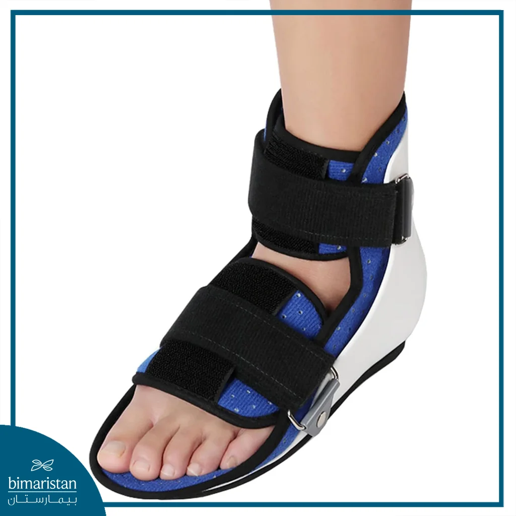 صورة تظهر الجبيرة التي يتم استخدامها في العلاج المحافظ