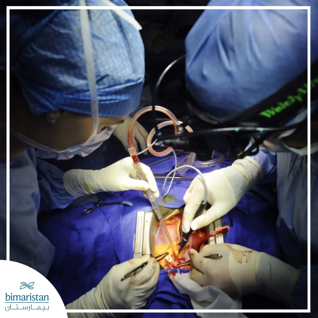 صورة توضح إجراء جراحة قلب مفتوح داخل غرفة العمليات