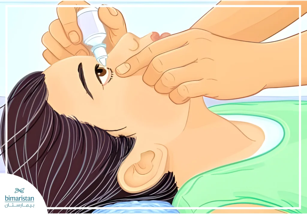 التهاب الملتحمة عند الأطفال: الأسباب والأعراض والعلاج والوقاية 4 صورة توضح العلاج الدوائي بالقطرات التي يتم استخدامه في معالجة التهاب الملتحمة عند الأطفال