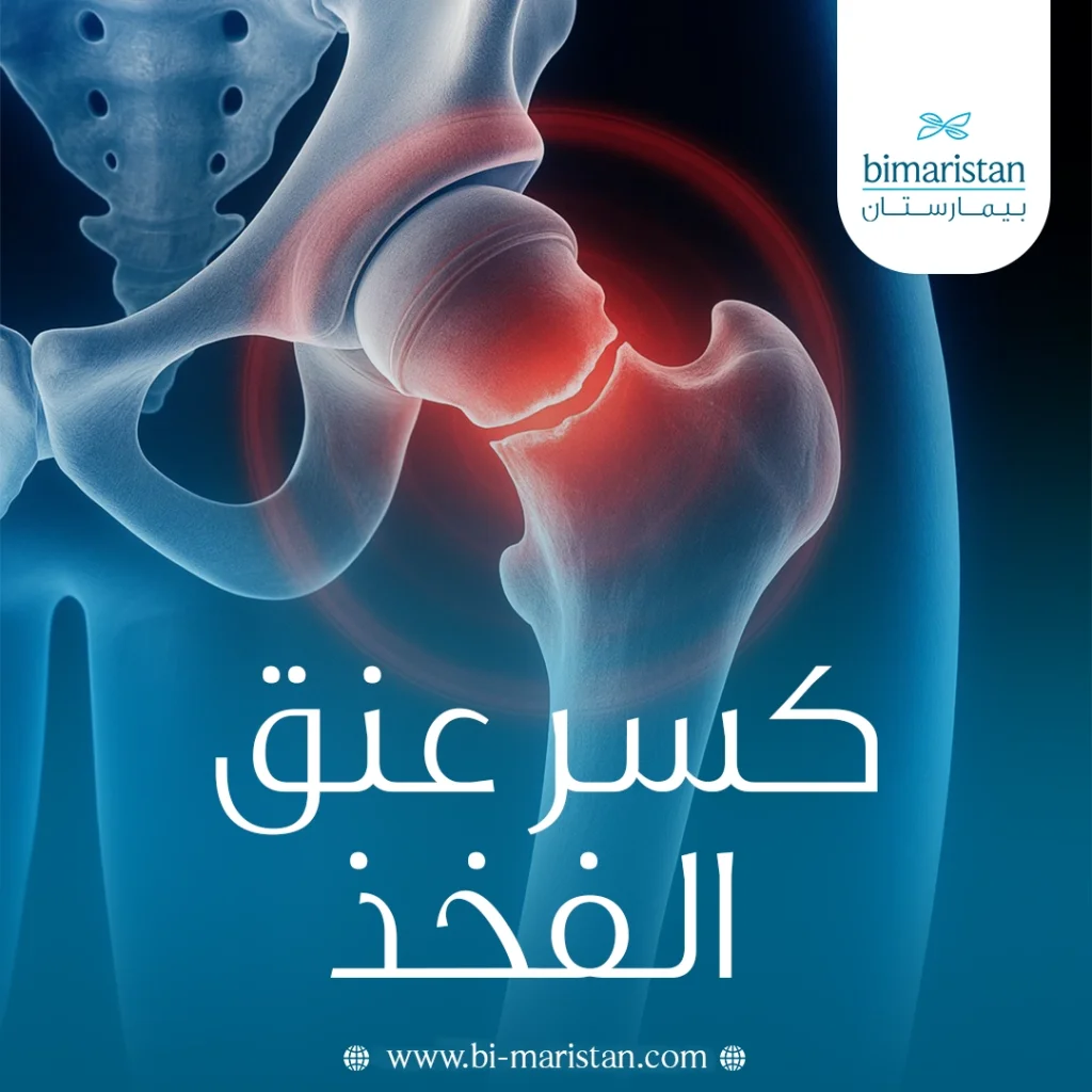 كسر عنق الفخذ: الأسباب والأعراض والتشخيص والعلاج - بيمارستان