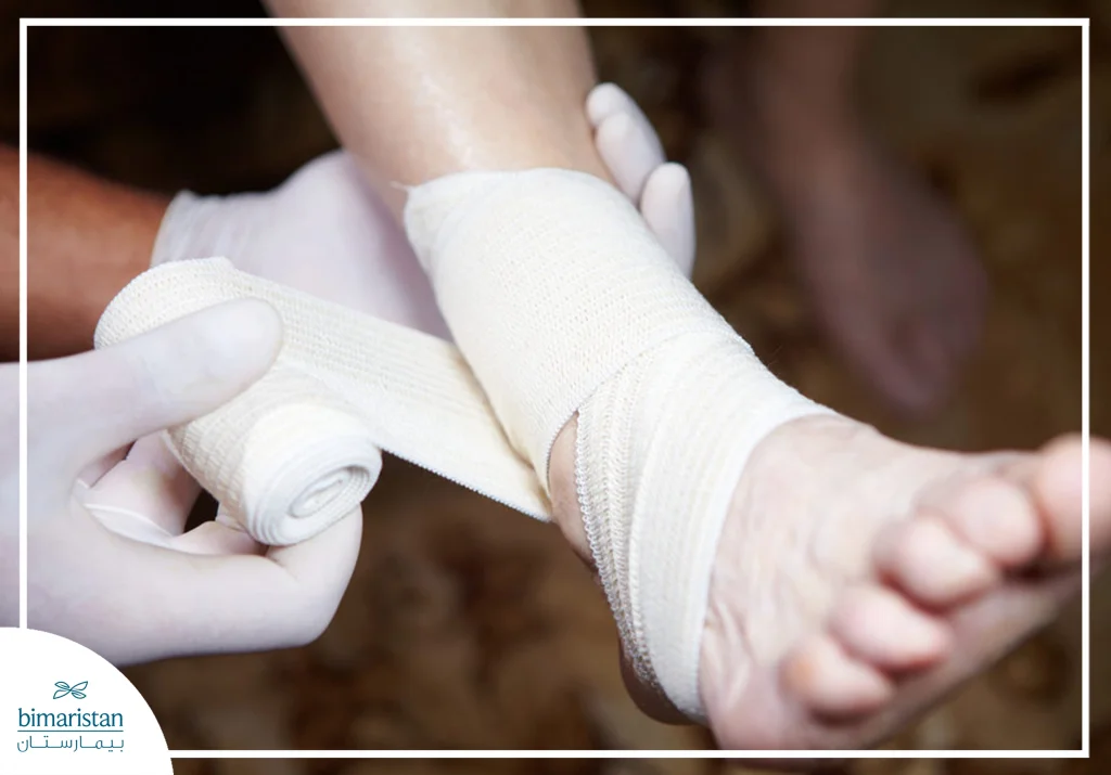 كل ما تريد معرفته عن كسور القدم